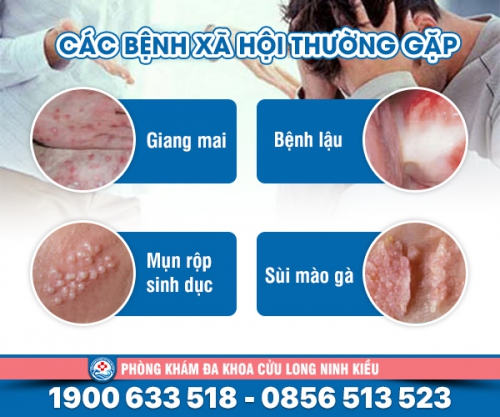 Bệnh xã hội là gì: Những điều cần biết