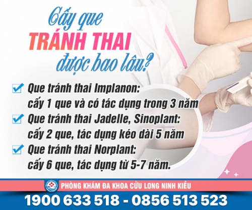 Chuyên gia tư vấn: cấy que tránh thai được bao lâu