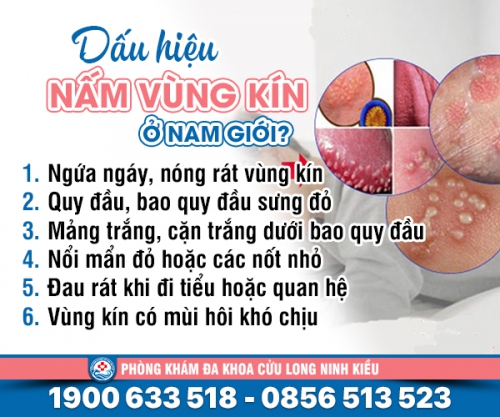 Nấm vùng kín ở nam giới đừng chủ quan kẻo hối hận