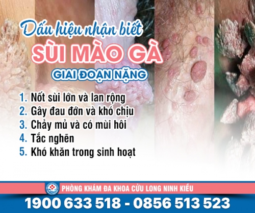 Bệnh sùi mào gà giai đoạn nặng - Đừng chủ quan khi mắc bệnh
