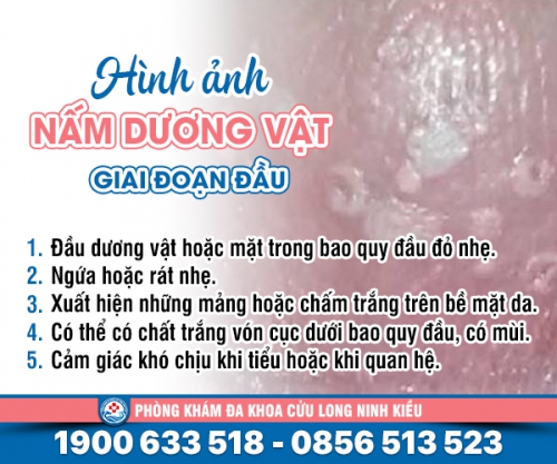Nhận biết: Hình ảnh nấm dương vật qua từng giai đoạn
