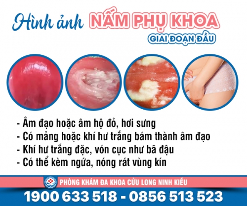 Nhận biết: Hình ảnh nấm phụ khoa