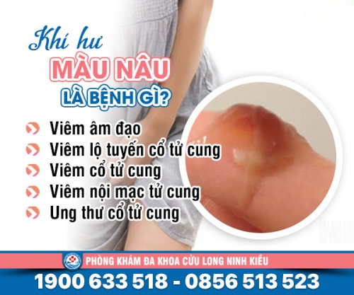 Khí hư màu nâu là bệnh gì: Những bệnh lý chị em cần lưu ý