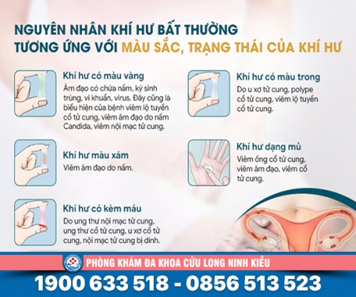 Giải đáp: Khí hư bất thường là bệnh gì