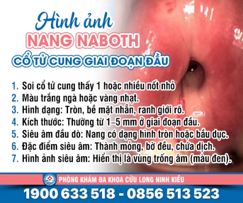 Phát hiện: Hình ảnh nang naboth cổ tử cung