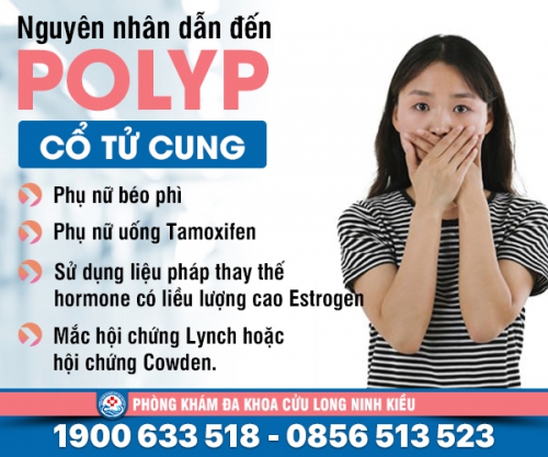 Nguyên nhân dẫn đến polyp cổ tử cung ít ai ngờ đến