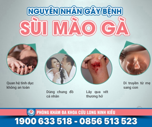 Bệnh sùi mào gà lây lan qua đường nào xem ngay