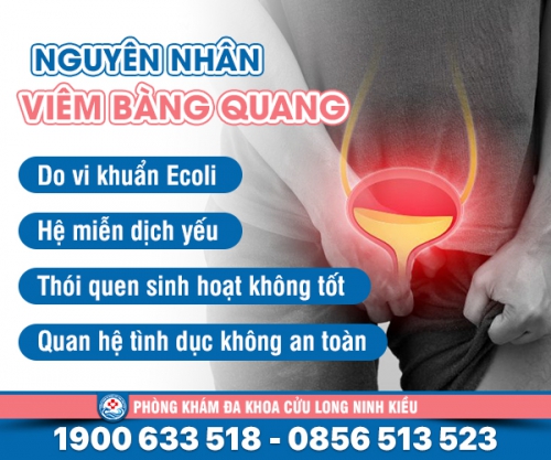 Vạch trần: nguyên nhân bị viêm bàng quang