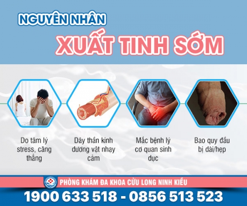 Nguyên nhân gây xuất tinh sớm điều nam giới không thể ngờ