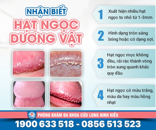 Hình ảnh hạt ngọc dương vật: Dấu hiệu nhận biết và cách phân biệt