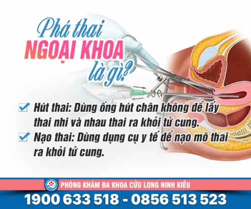 Phá thai ngoại khoa là gì: Những thông tin cần biết