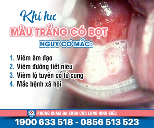 Khí hư màu trắng có bọt - cẩn trọng bệnh nguy hiểm