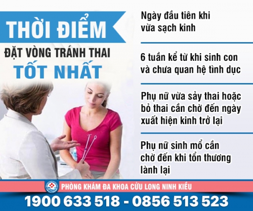 Tư vấn: Khi nào nên đặt vòng tránh thai
