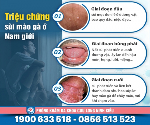 Bệnh sùi mào gà ở nam giới - Đừng chủ quan