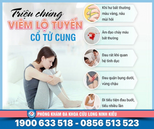 Đừng chủ quan với biểu hiện của bệnh viêm lộ tuyến