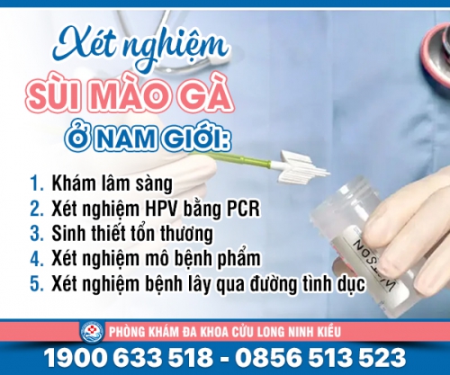 Tìm hiểu: Xét nghiệm sùi mào gà ở nam giới
