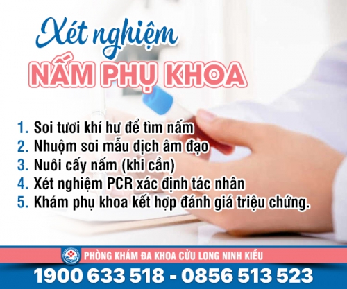 Xét nghiệm nấm phụ khoa cần thực hiện những gì