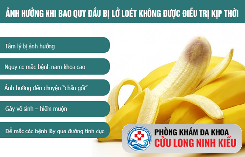 Cảnh báo về lở loét bao quy đầu và những hệ lụy khôn lường cho phái mạnh