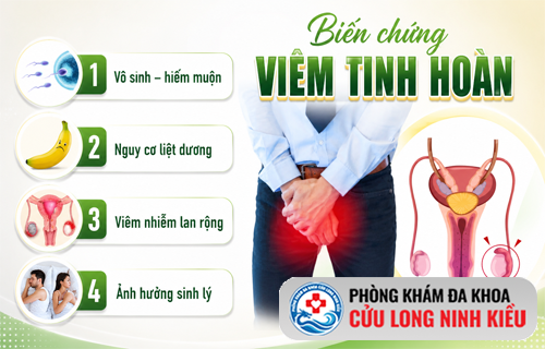 Đừng chủ quan với viêm tinh hoàn – Coi chừng biến chứng vô sinh