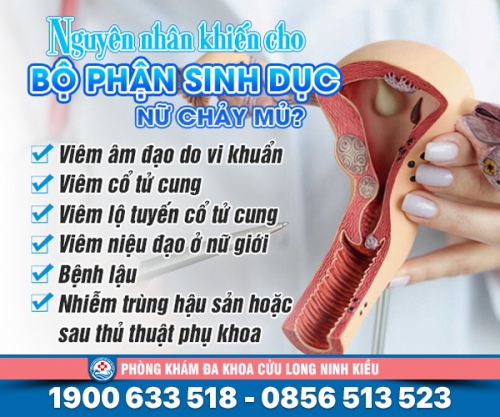 Bộ phận sinh dục nữ chảy mủ: Nguyên nhân và cách chữa