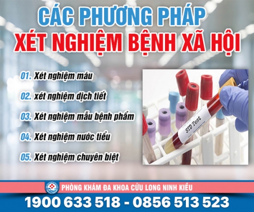 Xét nghiệm các bệnh lây qua đường tình dục
