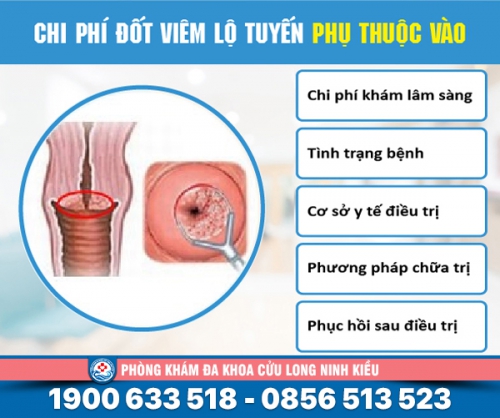Chi phí đốt lộ tuyến cổ tử cungbao nhiêu