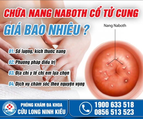 Tìm hiểu: Chữa nang naboth cổ tử cung giá bao nhiêu