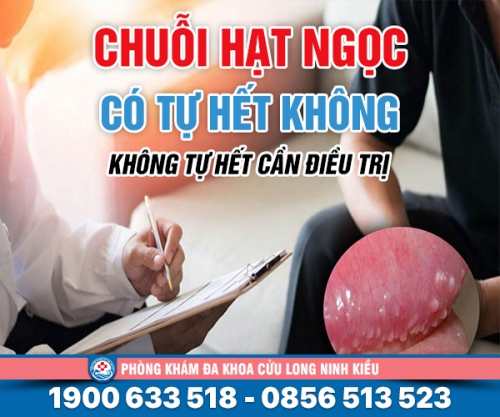 Tìm hiểu: chuỗi hạt ngọc có tự hết không?