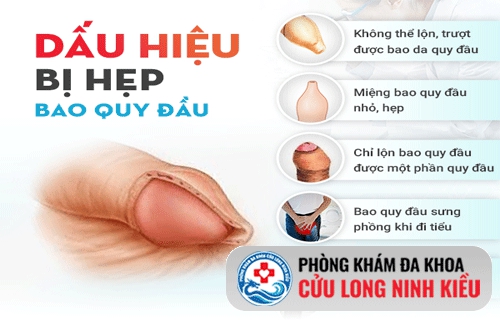 Hẹp bao quy đầu gây khó chịu? Đây là giải pháp xử lý nhẹ nhàng, ít xâm lấn