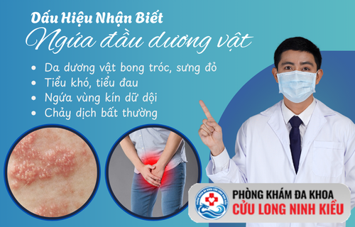 Cánh mày râu đang khốn khổ vì ngứa đầu dương vật? Đọc ngay bài này