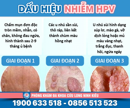 Tìm hiểu Dấu hiệu bị nhiễm hpv