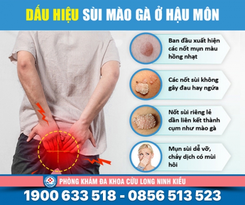 Bệnh sùi mào gà ở hậu môn nữ là gì