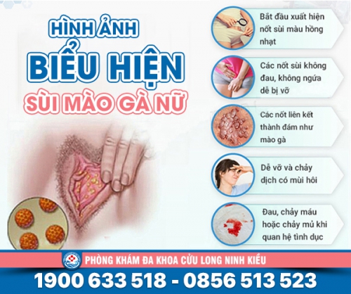 Tìm hiểu về bệnh sùi mào gà ở âm đạo, âm hộ