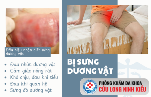 Nhận biết sớm hiện tượng sưng dương vật và những chuyển biến nguy hiểm