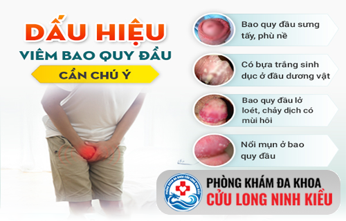 Cậu nhỏ có những biểu hiện này – Cảnh giác dấu hiệu viêm bao quy đầu