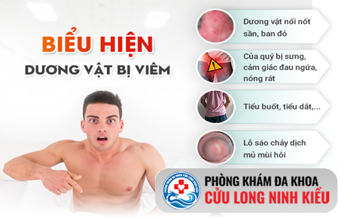 Viêm dương vật là bệnh gì? Góc nhìn chuyên sâu từ bác sĩ nam học