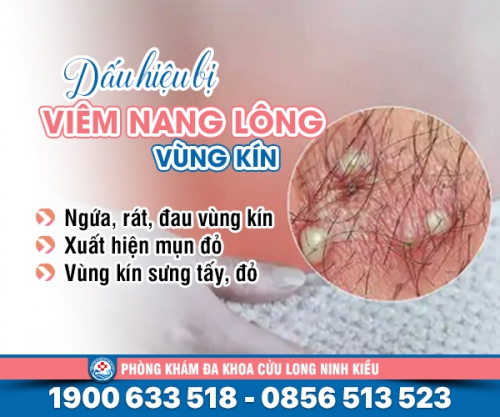 Bị viêm nang lông ở vùng kín là như thế nào? Tìm hiểu ngay