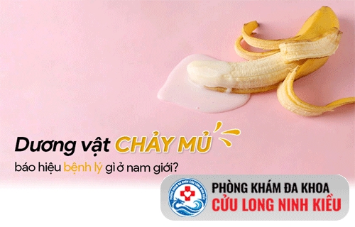 Mối nguy từ dương vật chảy mủ – Liệu có phải đã mắc bệnh lậu?