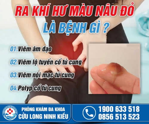 Khí hư màu nâu đỏ nguyên nhân do đâu? Cách khắc phục