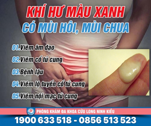Khí hư màu xanh có mùi hôi, mùi chua chớ chủ quan