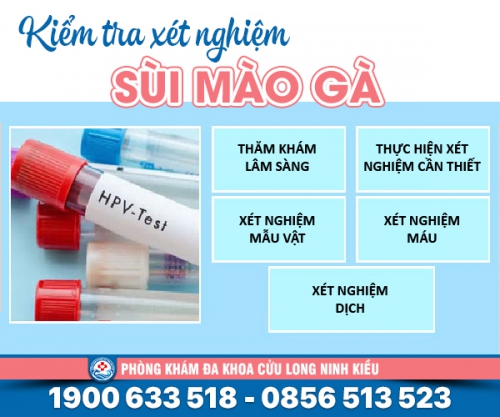 Kiểm tra xét nghiệm sùi mào gà - phát hiện bệnh sớm
