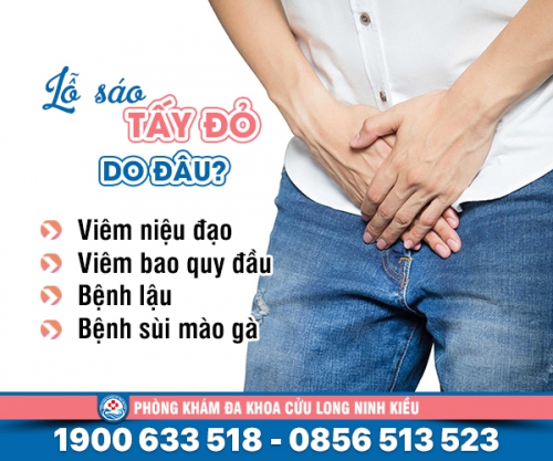Lỗ sáo tấy đỏ - Dấu hiệu bệnh lý nguy hiểm