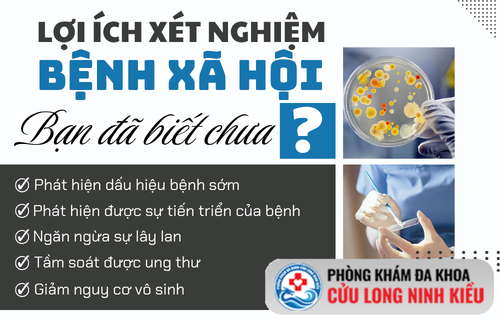 Tầm quan trọng của việc xét nghiệm bệnh xã hội – Bạn đã biết chưa?