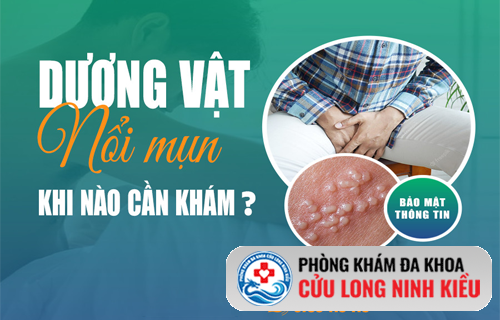 Cảnh giác với tình trạng mụn dương vật – Liệu có phải mắc bệnh xã hội?