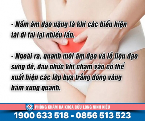 Nấm âm đạo nặng: Nguyên nhân, biểu hiện và phương pháp chữa trị