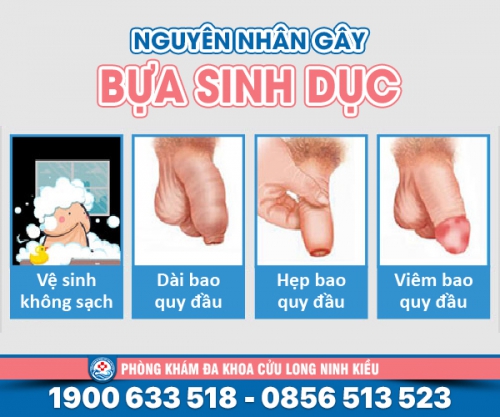 Tìm hiểu những thông tin về bựa sinh dục