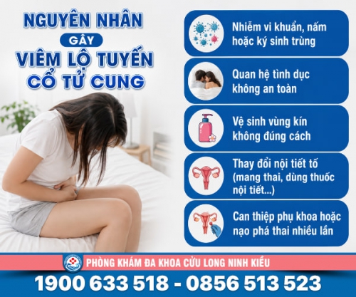 Chia sẻ: Nguyên nhân viêm lộ tuyến cổ tử cung