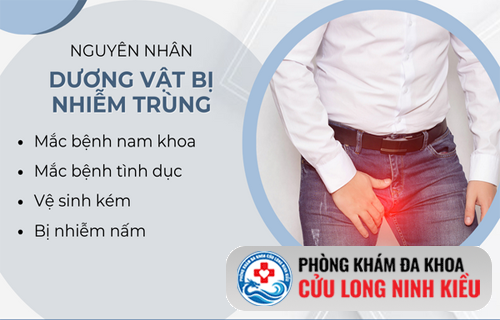 Chớ nên xem nhẹ những dấu hiệu nhiễm trùng dương vật ở các quý ông