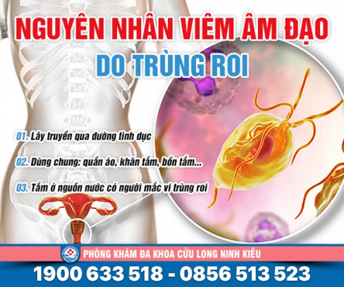 Viêm âm đạo do trùng roi: Nguyên nhân dấu hiệu và cách khắc phục