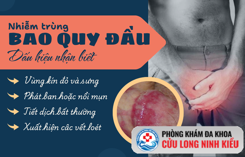 Dấu hiệu thực tiễn về bao quy đầu nhiễm trùng và phác đồ điều trị an toàn